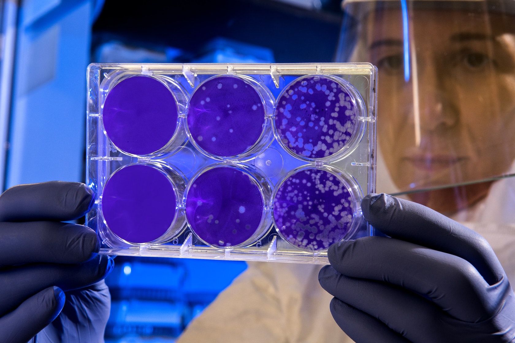 lab work